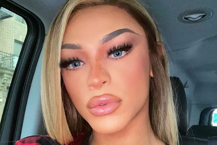 Pabllo Vittar surge hematomas no corpo e levanta suspeitas Área VIP