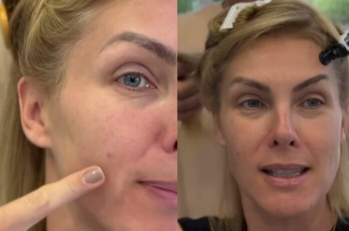 Ana Hickmann Surge Sem Maquiagem E Choca F S Uma Adolescente Rea Vip