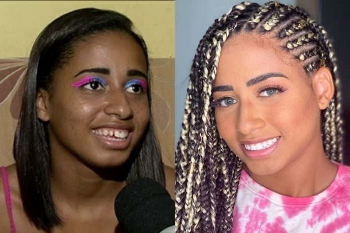 Mc Loma antes e depois - Reprodução: Instagram (Montagem: Área VIP)