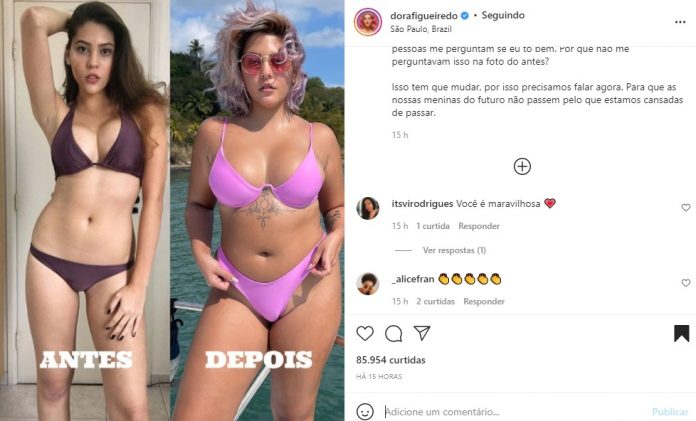 Dora Figueiredo Revela Problemas Com Anorexia Me Via Gorda Mesmo Sendo Magra Área Vip 1703