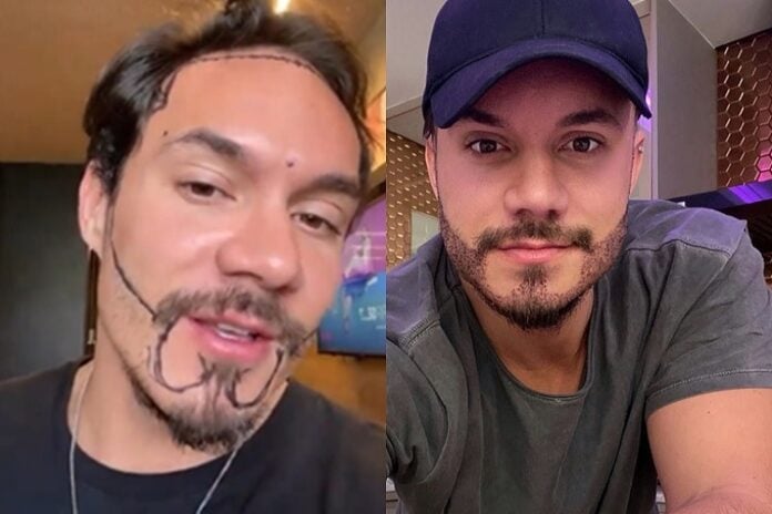 Ex-BBB Eliezer passou por transplante de barba e cabelo (Foto: Reprodução/Montagem/Instagram)