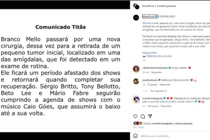 O comunicado feito pela equipe do Titãs sobre a saúde de Branco Mello (Reprodução: Instagram)