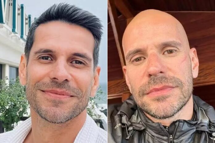 Antes de depois de Alexandre